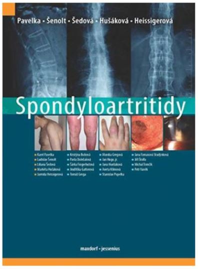 Spondyloartritidy