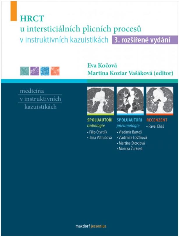 HRCT u intersticiálních plicních procesů v instruktivních kazuistikách